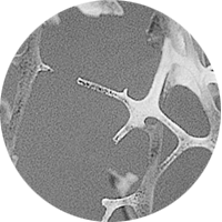 Abnormal Structure